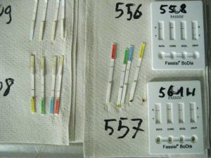 verschiedene Teststäbchen eines Schnelltests
